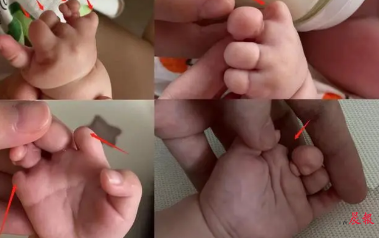 福州助孕机构